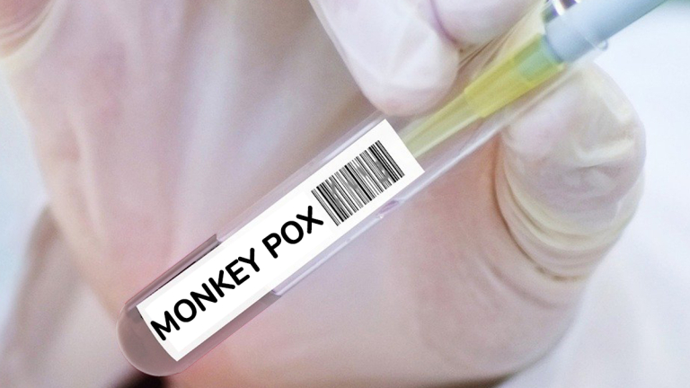 Monkeypox च्या संशयित रूग्णांना हाताळण्यासाठी AIIMS Delhi कडून प्रोटोकॉल जारी