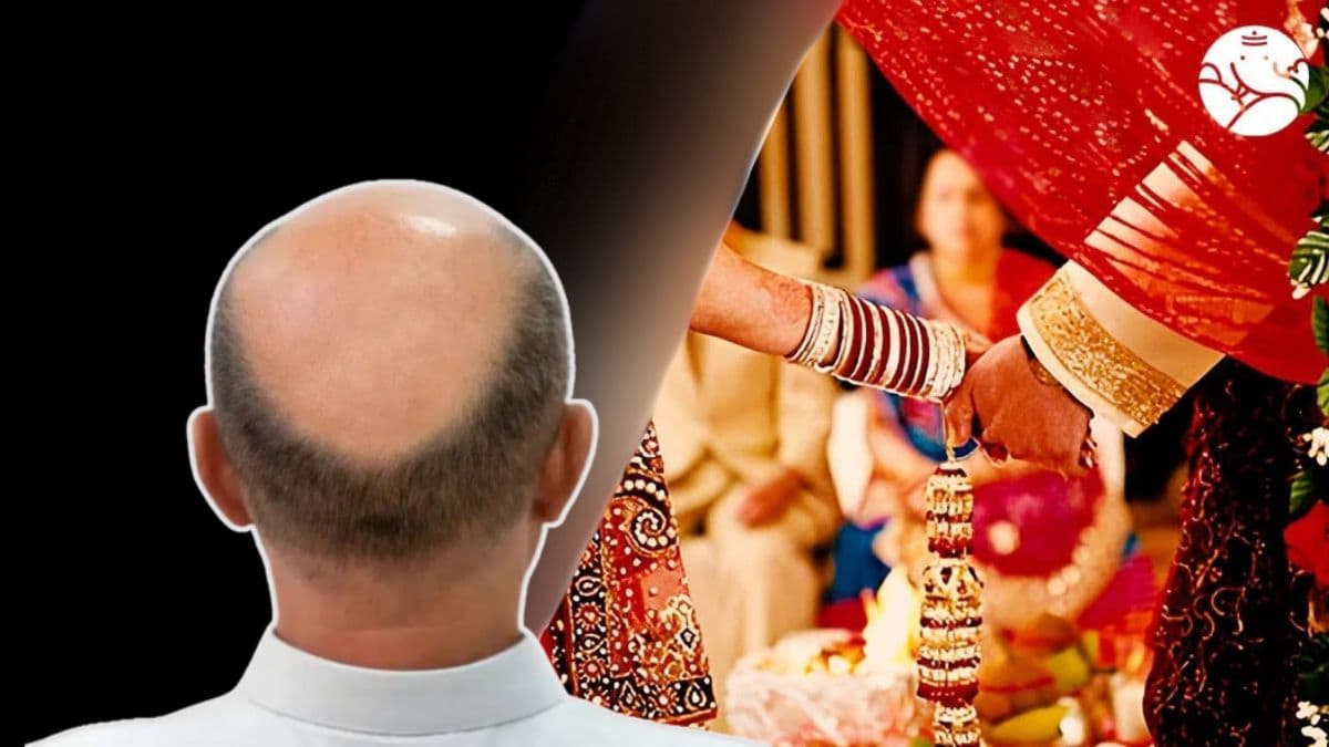 Buldhana Hair Loss: टक्कल व्हायरस लग्नास अडथळा, तरुणाईचे विवाह रखडले; केस गळणे, टक्कल पडणे समस्येने गावकरी हैराण