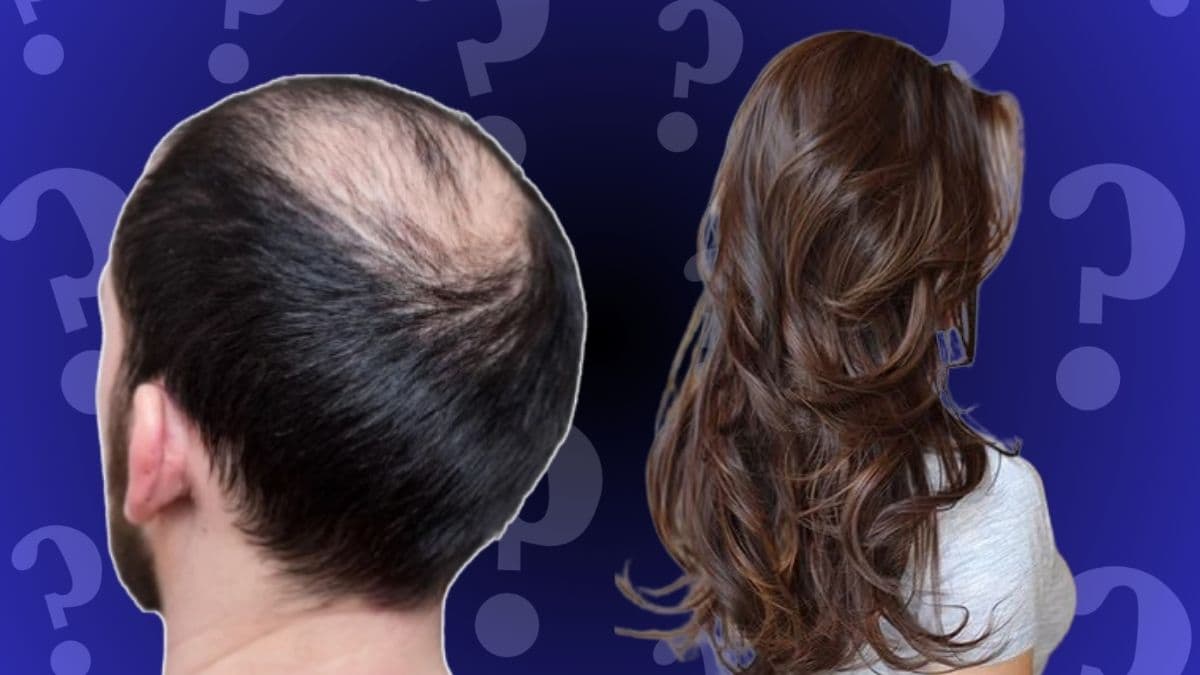 Hair Loss Outbreak Buldhana: केस गळणे, टक्कल पडणे प्रकरणी ICMR द्वारे चौकशी; दिल्ली, चेन्नईचे पथक बुलढाणा जिल्ह्यात