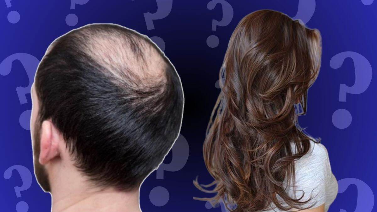 Hair Loss Outbreak in Maharashtra: भयानक केसगळती, अनेकांना टक्कल, नागरिक हैराण; महाराष्ट्रातील अनेक गावांमध्ये विचित्र आजार