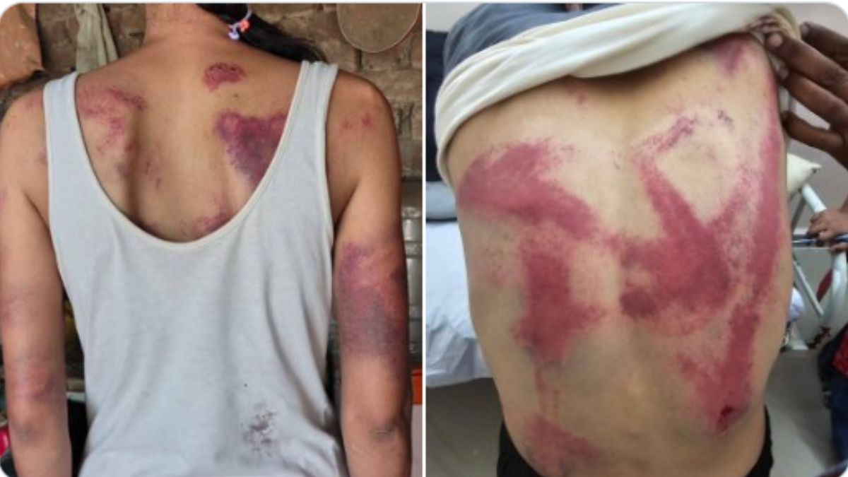 Female Lawyer Assaulted Beed: बीड येथे महिला वकिलास बेदम मारहाण, जितेंद्र आव्हाड यांच्या एक्स पोस्टनंतर खळबळ
