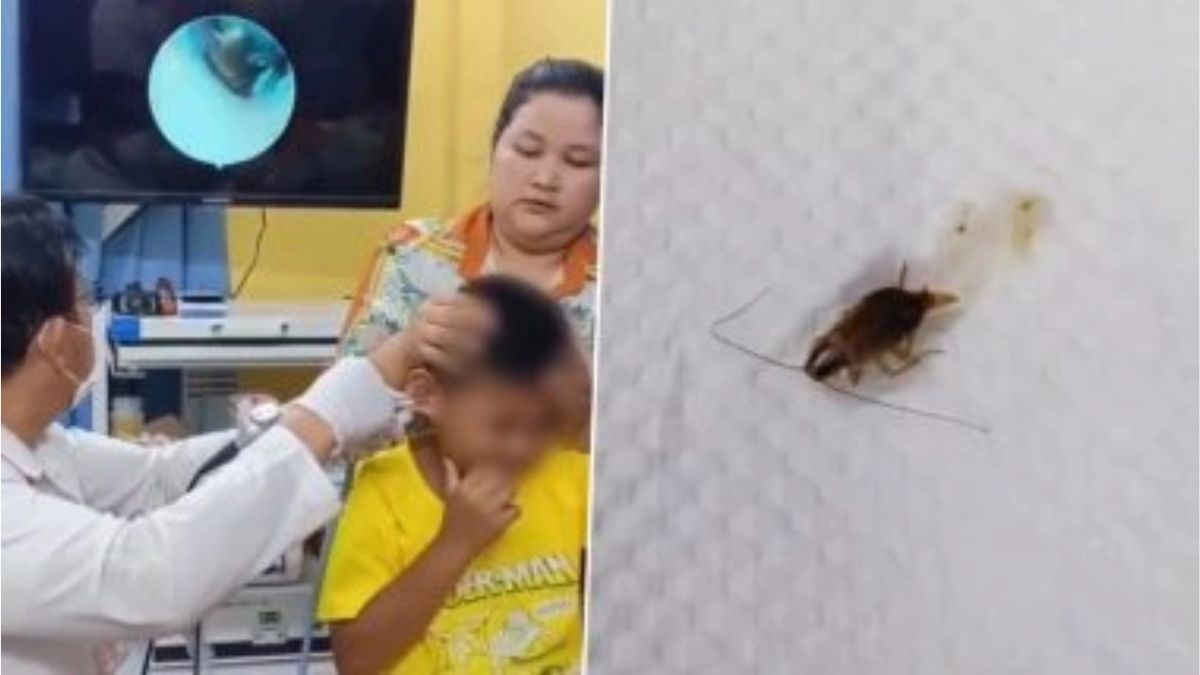 Viral: धक्कादायक! कंबोडियामध्ये मुलाच्या कानात घुसला जिवंत झुरळ, डॉक्टरांनी सुरक्षितपणे काढले बाहेर; पाहा व्हायरल व्हिडिओ