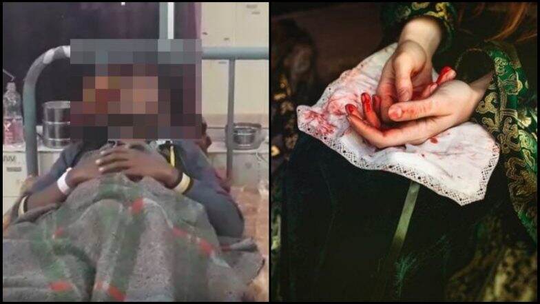 रात्रीच्या काळोखात बायकोने कापले नवऱ्याचे गुप्तांग रात्रीच्या काळोखात बायकोने कापले नवऱ्याचे गुप्तांग