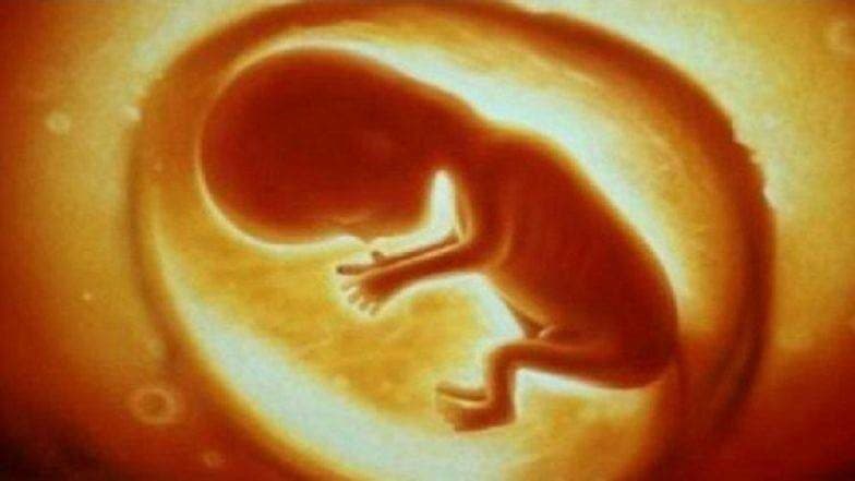 Foetal Repair शस्त्रक्रियेची किमया; लंडनमध्ये गर्भातच दुरुस्त केला बाळाच्या पाठीच्या कण्यातील दोष Foetal Repair शस्त्रक्रियेची किमया; लंडनमध्ये गर्भातच दुरुस्त केला बाळाच्या पाठीच्या कण्यातील दोष