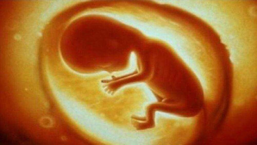 Foetal Repair शस्त्रक्रियेची किमया; लंडनमध्ये गर्भातच दुरुस्त केला बाळाच्या पाठीच्या कण्यातील दोष Foetal Repair शस्त्रक्रियेची किमया; लंडनमध्ये गर्भातच दुरुस्त केला बाळाच्या पाठीच्या कण्यातील दोष