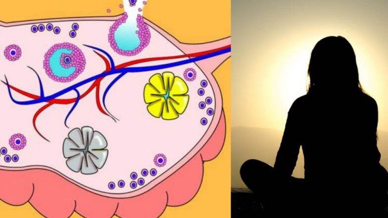 PCOD: तरुणी, स्त्रियांमध्ये भीती आणि न्यूनगंड निर्माण करणाऱ्या या आजाराची लक्षणं, कारणं, उपचार आणि उपाय याबाबतचा एक्सपर्ट सल्ला PCOD: तरुणी, स्त्रियांमध्ये भीती आणि न्यूनगंड निर्माण करणाऱ्या या आजाराची लक्षणं, कारणं, उपचार आणि उपाय याबाबतचा एक्सपर्ट सल्ला