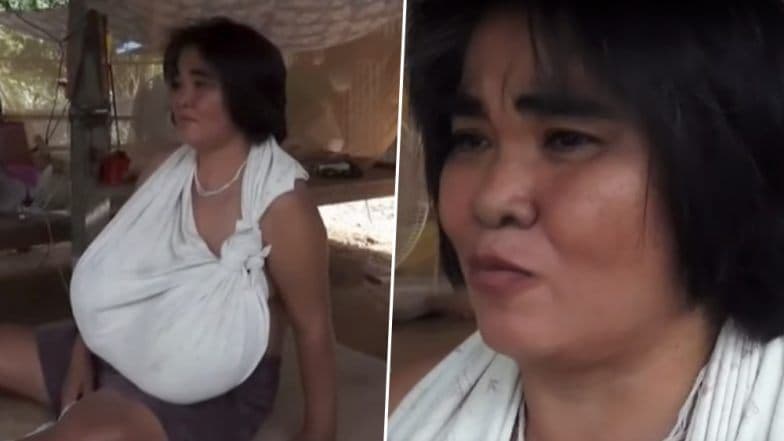 चमत्कारिक वेगाने वाढत आहेत 'या' महिलेचे Breast, चालण्यासाठी सुद्धा घ्यावा लागतो कुबड्यांचा आधार (Watch Video) चमत्कारिक वेगाने वाढत आहेत 'या' महिलेचे Breast, चालण्यासाठी सुद्धा घ्यावा लागतो कुबड्यांचा आधार (Watch Video)