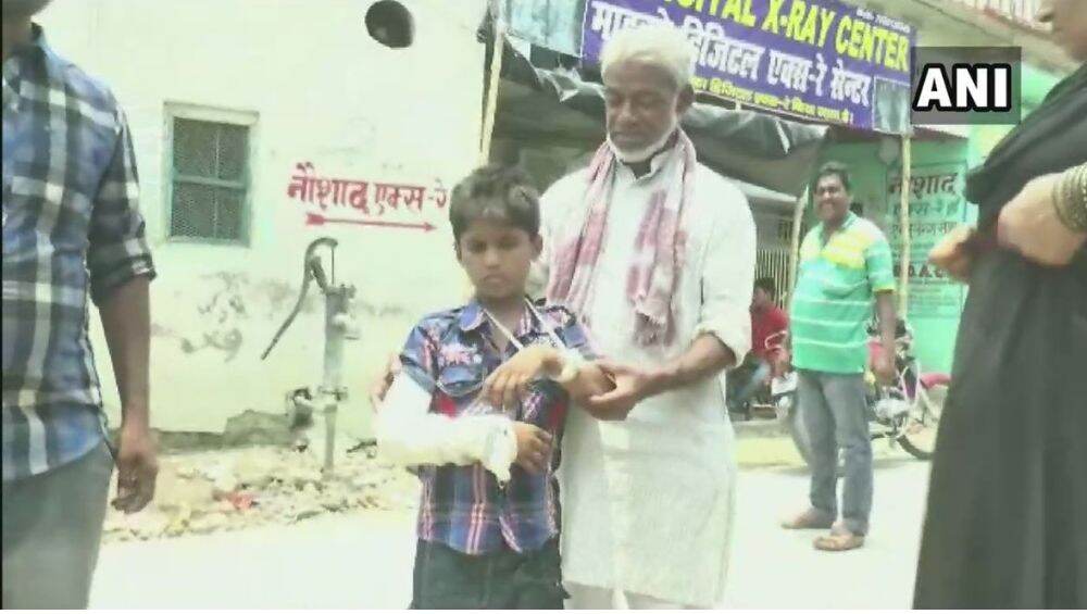 बिहार: डॉक्टरांचा कहर! मुलाच्या डाव्या हाताला फ्रॅक्चर, पण उजव्या हाताला केले प्लास्टर बिहार: डॉक्टरांचा कहर! मुलाच्या डाव्या हाताला फ्रॅक्चर, पण उजव्या हाताला केले प्लास्टर