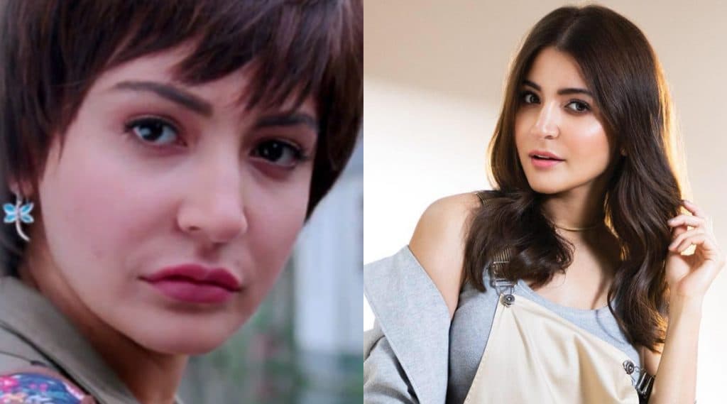 Anushka Sharma ने पीके चित्रपटासाठी केली होती चेहऱ्यावर शस्त्रक्रिया; पहा दोन्ही फोटोंमधील फरक Anushka Sharma ने पीके चित्रपटासाठी केली होती चेहऱ्यावर शस्त्रक्रिया; पहा दोन्ही फोटोंमधील फरक