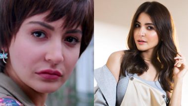 Anushka Sharma ने पीके चित्रपटासाठी केली होती चेहऱ्यावर शस्त्रक्रिया; पहा दोन्ही फोटोंमधील फरक