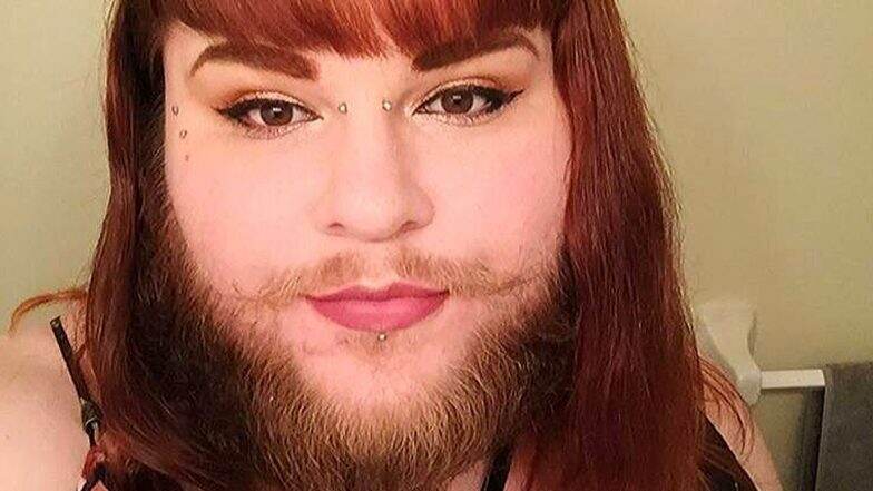 महिलांनो Facial Hair मुळे त्रस्त? जाणून घ्या चेहऱ्यावरील अनावश्यक केस काढण्यासाठी काही महत्वाचे उपाय महिलांनो Facial Hair मुळे त्रस्त? जाणून घ्या चेहऱ्यावरील अनावश्यक केस काढण्यासाठी काही महत्वाचे उपाय