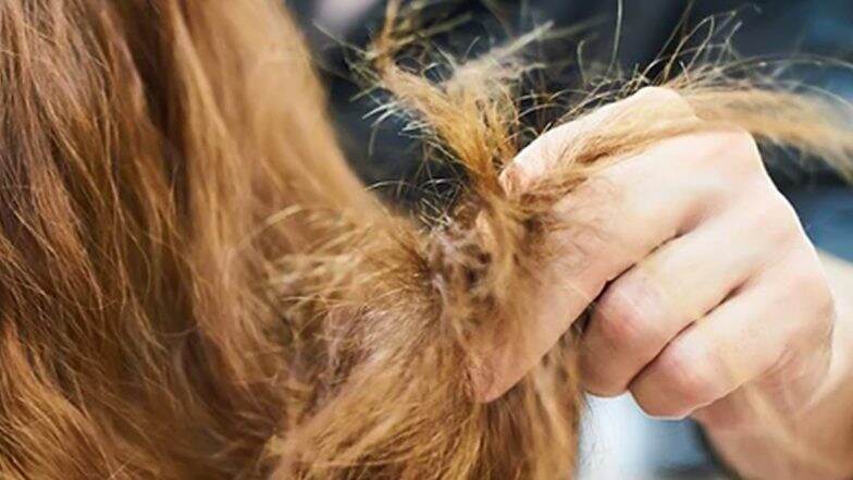 Hair Care Tips: рдХреЗрд╕рд╛рдВрдирд╛ рдлрд╛рдЯреЗ рдлреБрдЯрдгреНрдпрд╛рдЪреНрдпрд╛ рд╕рдорд╕реНрдпреЗрд╡рд░ '5' рдЭрдЯрдкрдЯ рдШрд░рдЧреБрддреА рдЙрдкрд╛рдп