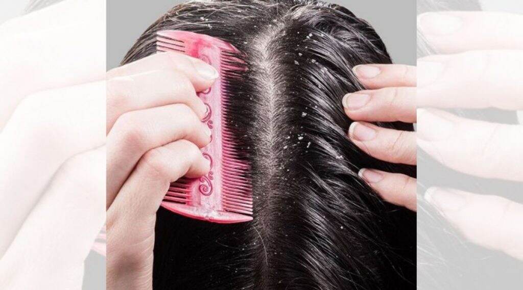 Winter Hair Care Tips: थंडीत केसांमध्ये होणारा कोंडा दूर करण्यासाठी करा हे '5' नैसर्गिक उपाय Winter Hair Care Tips: थंडीत केसांमध्ये होणारा कोंडा दूर करण्यासाठी करा हे '5' नैसर्गिक उपाय