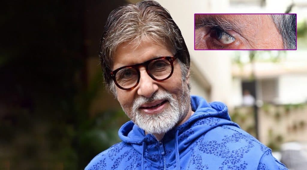 अमिताभ बच्चन यांच्या डोळ्यात हा काळा ठिपका कसला?; बिग बींनाही वाटली चिंता, तत्काळ घेतला डॉक्टरांचा सल्ला अमिताभ बच्चन यांच्या डोळ्यात हा काळा ठिपका कसला?; बिग बींनाही वाटली चिंता, तत्काळ घेतला डॉक्टरांचा सल्ला