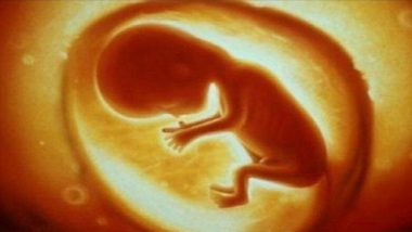 निसर्गाचा चमत्कार! 6 महिन्यांच्या बाळाच्या पोटातून काढला 250 ग्रॅम वजनाचा गर्भ; ऑपरेशननंतर मुलाची प्रकृती स्थिर