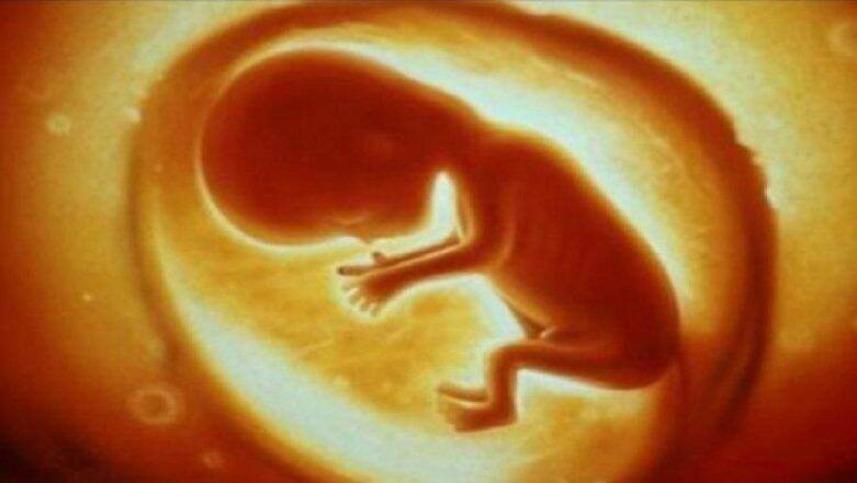 निसर्गाचा चमत्कार! 6 महिन्यांच्या बाळाच्या पोटातून काढला 250 ग्रॅम वजनाचा गर्भ; ऑपरेशननंतर मुलाची प्रकृती स्थिर निसर्गाचा चमत्कार! 6 महिन्यांच्या बाळाच्या पोटातून काढला 250 ग्रॅम वजनाचा गर्भ; ऑपरेशननंतर मुलाची प्रकृती स्थिर