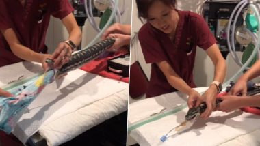 ऑस्ट्रेलिया: सापाने गिळलेला टॉवेल डॉक्टरांनी कसा काढला, पहा व्हायरल व्हिडिओ