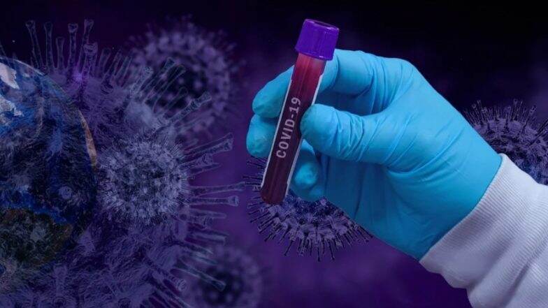 Coronavirus: जगभरातील कोरोना व्हायरस रुग्णांची संख्या 55 लाखाच्या जवळ; 3 लाख 46 हजारांहून अधिक मृत्यू; अमेरिका, ब्राझिल, रशिया, इंग्लंड आघाडीवर