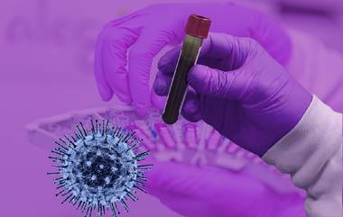 Coronavirus in Mumbai: मुंबईमध्ये आज कोरोना विषाणूच्या नवीन 5,631 रुग्णांची नोंद; सध्या 16,441 सक्रीय रुग्णांवर उपचार सुरु