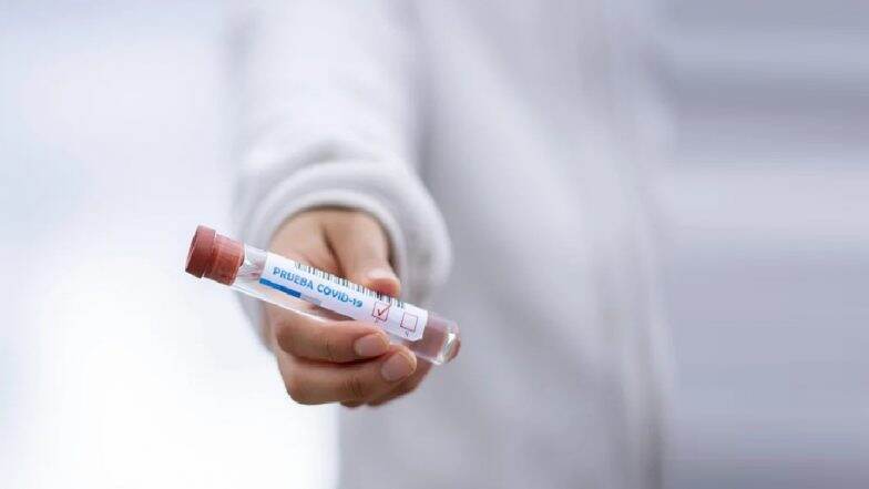 Coronavirus: मुंबई शहरातील कोरोना व्हायरस संक्रमितांची संख्या 36,710; दिवसभरात 1437 नव्या रुग्णांची नोंद