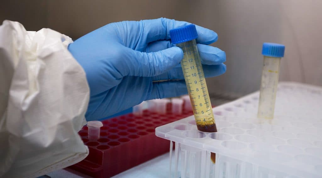 मुंबई: नायर, कस्तुरबा हॉस्पिटल मध्ये Convalescent Plasma Trials साठी ICMR कडून परवानगी मुंबई: नायर, कस्तुरबा हॉस्पिटल मध्ये Convalescent Plasma Trials साठी ICMR कडून परवानगी