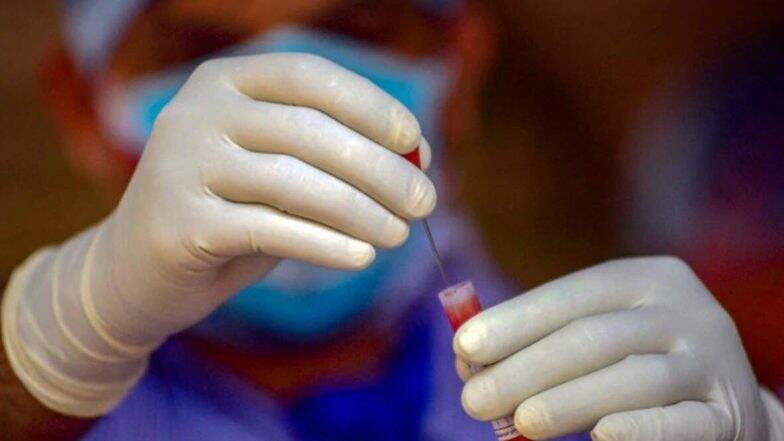 Coronavirus In India: भारतामध्ये मागील 24 तासांत 83,809 नव्या रूग्णांची भर एकूण कोरोनाबाधित 49 लाखांच्या पार