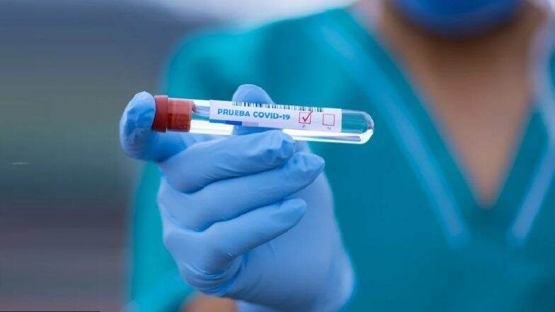Coronavirus: जगभरात 51 लाखांहून अधिक नागरिकांना कोरोना व्हायरस संक्रमन, 3 लाख 32 हजार पेक्षा अधिक रुग्णांचा मृत्यू
