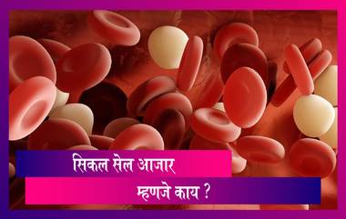 World Sickle Cell Day : 'जागतिक सिकल सेल दिवस' निमित्त जाणून घ्या सिकल सेल आजाराची लक्षणं आणि उपचार