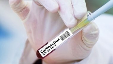 Coronavirus In India: भारतामध्ये 24 तासांत कोरोनाचे 62,064 नवे रूग्ण,1007 जणांचा मृत्यू; एकूण रूग्ण्संख्या 22,15,075 वर!