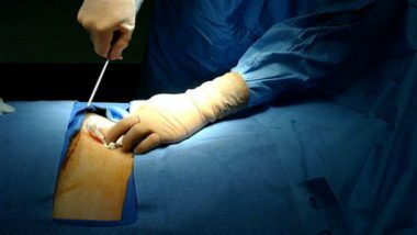 Pune: भारतात पहिल्यांदाच कोरोना बाधित रुग्णावर Intestine Transplant शस्त्रक्रिया; वडीलांनी 200cm आतडं दान करुन वाचवले मुलाचे प्राण