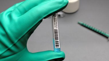 New Strain of Coronavirus in India: भारतामध्ये ब्रिटन मधीन नवीन कोरोना वायरसची लागण असलेल्या रूग्णांची संख्या 29 वर