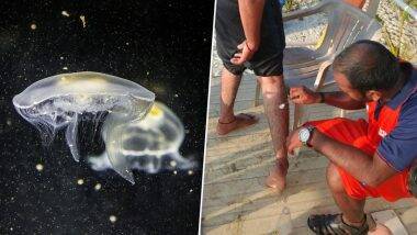 Jellyfish Swarms Invade Goa Beaches: गोव्याच्या समुद्र किनारी जेलीफिशची दहशत; Baga, Calangute, Candolim व Sinquerim बीचजवळ स्टिंगच्या 90 प्रकरणांची नोंद