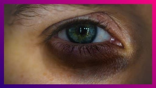 Home Remedies For Remove Dark Circles: डोळ्यांखालचे काळी वर्तुळ घालवण्यासाठी करा 'हे ' 5 महत्वाचे घरगुती उपाय