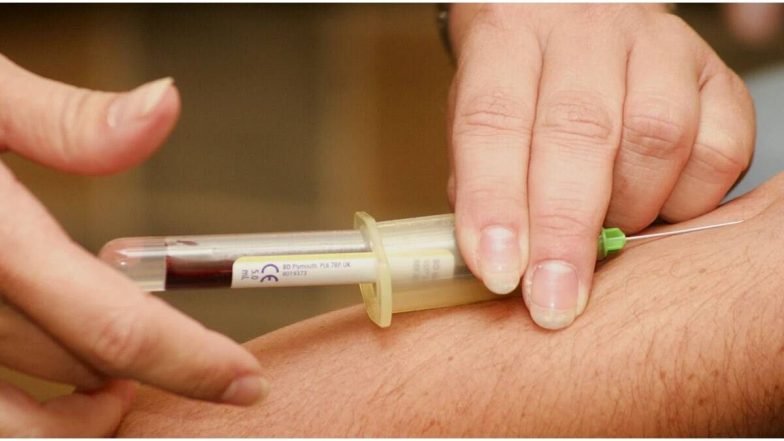 Plasma Donation: कोरोनावर मात केल्यानंतर किती दिवसानंतर प्लाझ्मा दान करू शकतात? त्यासाठी कोणत्या गोष्टी आवश्यक आहेत? जाणून घ्या सविस्तर