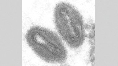 Monkeypox Virus: महाराष्ट्र आरोग्य विभागाकडून मंकीपॉक्सबाबत मार्गदर्शक तत्त्वे जारी, लक्षणे असलेल्या व्यक्तींवर लक्ष ठेवण्याचे केले आवाहन