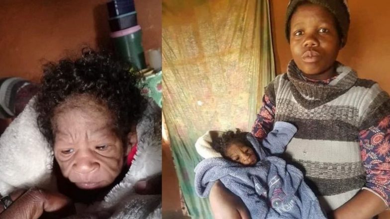 South Africa: महिलेने जन्म दिला चक्क 60 वर्षांची म्हातारी दिसणाऱ्या बाळाला; कुटुंबीय झाले स्तब्ध, जाणून घ्या काय आहे प्रकरण