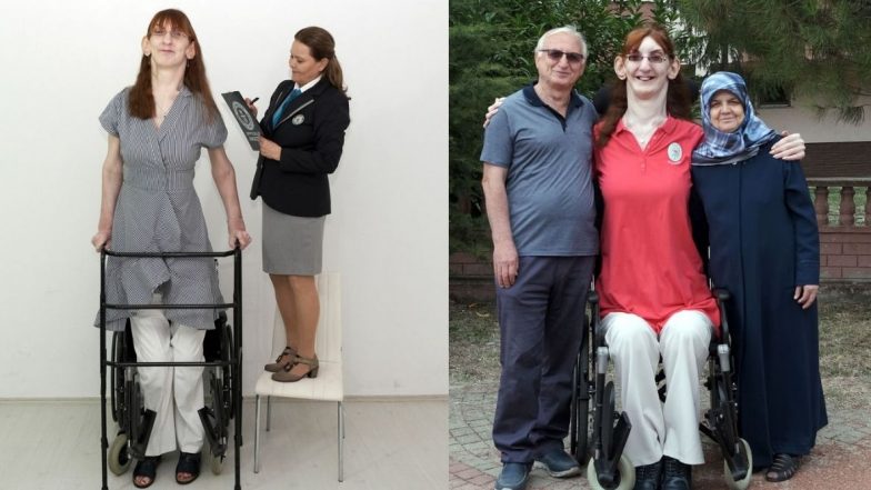 Tallest Woman Alive: तुर्कीची 24 वर्षीय Rumeysa Gelgi ठरली सर्वात उंच जिवंत असलेली महिला; 7'7 इंच आहे उंची, फिरण्यासाठी करते व्हीलचेअरचा वापर