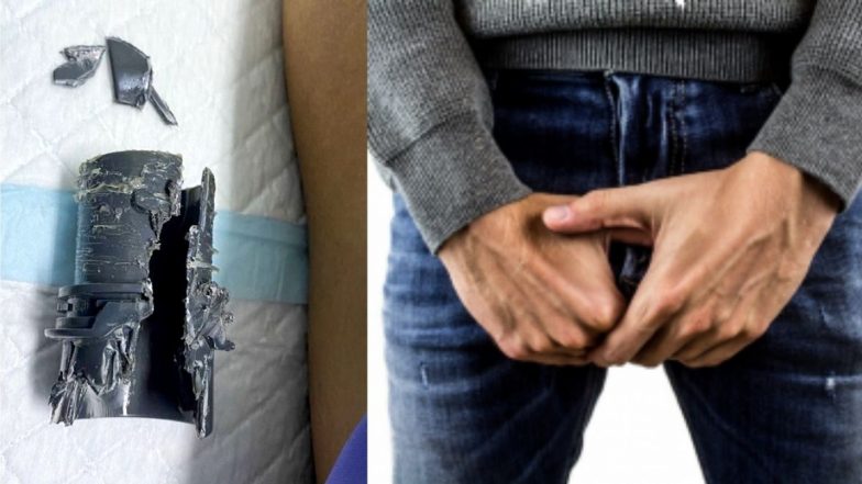 Penis Stuck in Tube: लिंगाची लांबी मोजणे पडले महागात, ट्यूबमध्ये अडकला प्रायव्हेट पार्ट; करावे लागली शस्त्रक्रिया