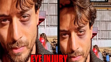 Tiger Shroff च्या  डोळ्याला दुखापत, गणपत सिनेमासाठी स्टंट करतांना झाला अपघात