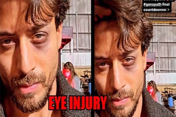 Tiger Shroff च्या  डोळ्याला दुखापत, गणपत सिनेमासाठी स्टंट करतांना झाला अपघात