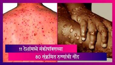 Monkeypox Outbreak: 11 рджреЗрд╢рд╛рдВрдордзреНрдпреЗ рдордВрдХреАрдкреЙрдХреНрд╕рдЪреНрдпрд╛ 80 рд╕рдВрдХреНрд░рдорд┐рдд рд░реБрдЧреНрдгрд╛рдВрдЪреА рдиреЛрдВрдж, рднрд╛рд░рддрд╛рд▓рд╛рд╣реА рдзреЛрдХрд╛? Monkeypox Outbreak: 11 рджреЗрд╢рд╛рдВрдордзреНрдпреЗ рдордВрдХреАрдкреЙрдХреНрд╕рдЪреНрдпрд╛ 80 рд╕рдВрдХреНрд░рдорд┐рдд рд░реБрдЧреНрдгрд╛рдВрдЪреА рдиреЛрдВрдж, рднрд╛рд░рддрд╛рд▓рд╛рд╣реА рдзреЛрдХрд╛?