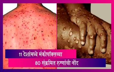 Monkeypox Outbreak: 11 देशांमध्ये मंकीपॉक्सच्या 80 संक्रमित रुग्णांची नोंद, भारतालाही धोका?