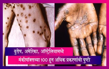 Monkeypox : युरोप, अमेरिका, ऑस्ट्रेलियामध्ये 100 हून अधिक प्रकरणांची पुष्टी, प्रकरणामध्ये वाढ होण्याची शक्यता