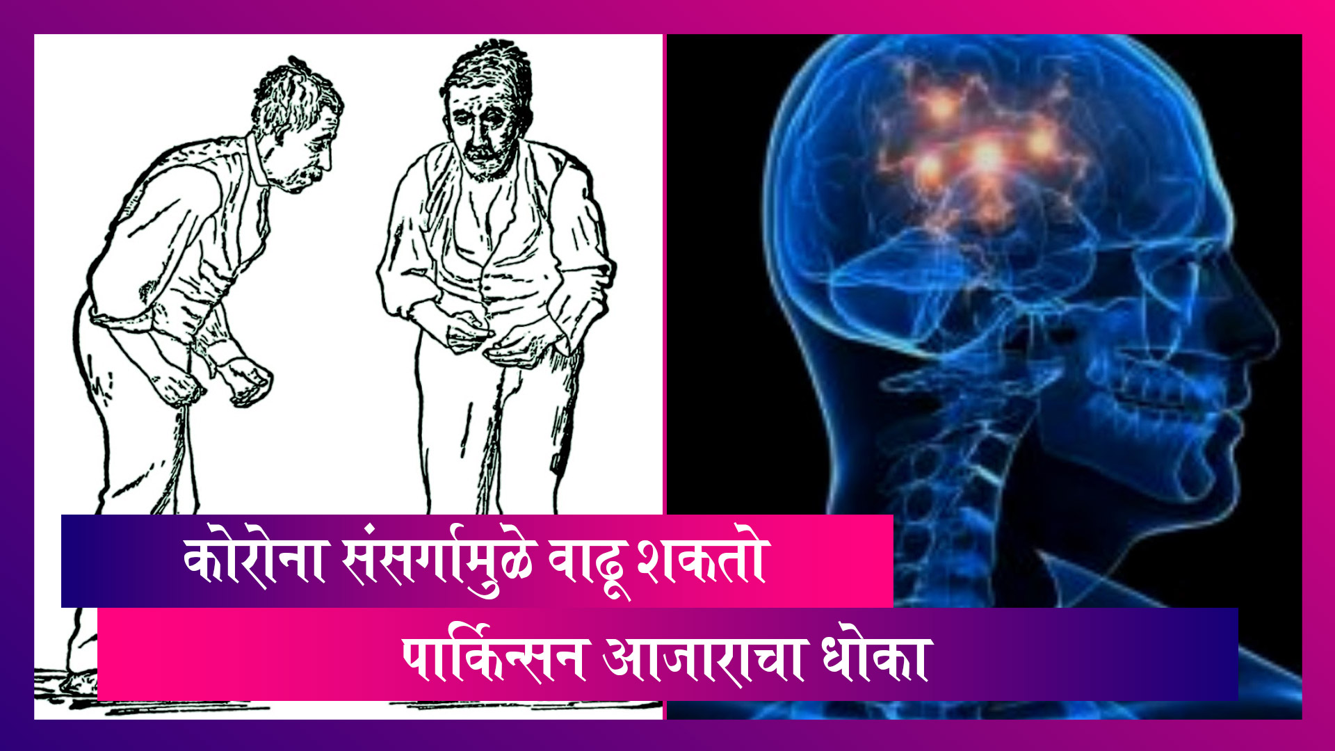 Parkinson's Disease:कोरोना संसर्गामुळे वाढू शकतो पार्किन्सन आजाराचा धोका; संशोधनात करण्यात आला दावा