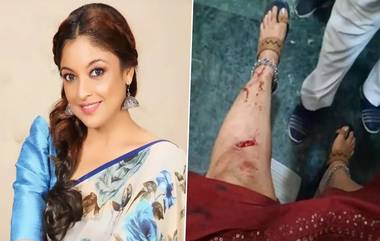 Tanushree Dutta Accident: अभिनेत्री तनुश्री दत्ताचा अपघात; मंदिरात जाताना गाडीचे ब्रेक झाले फेल