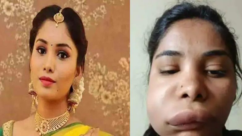 Shocking! शस्त्रक्रियेनंतर बिघडला लोकप्रिय अभिनेत्रीचा चेहरा; ओळखणे झाले कठीण (See Photos)