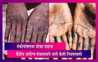 Monkeypox Guidelines: मंकीपॉक्सचा धोका पाहता केंद्रीय आरोग्य मंत्रालयाने जारी केली नियमावली