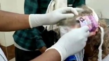 Madhya Pradesh: जखमी महिलेच्या डोक्यावर बांधले कंडोमचं रॅपर, पट्टी उघडताच डॉक्टर थक्क