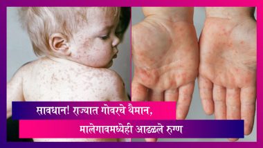 Measles In Maharashtra: सावधान! राज्यात गोवरचे थैमान, मालेगावमध्येही आढळले रुग्ण