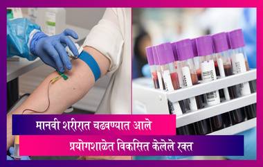 Lab grown Blood to Humans: मानवी शरीरात चढवण्यात आले प्रयोगशाळेत विकसित केलेले रक्त; निकालांकडे लागले संपूर्ण जगाचे लक्ष